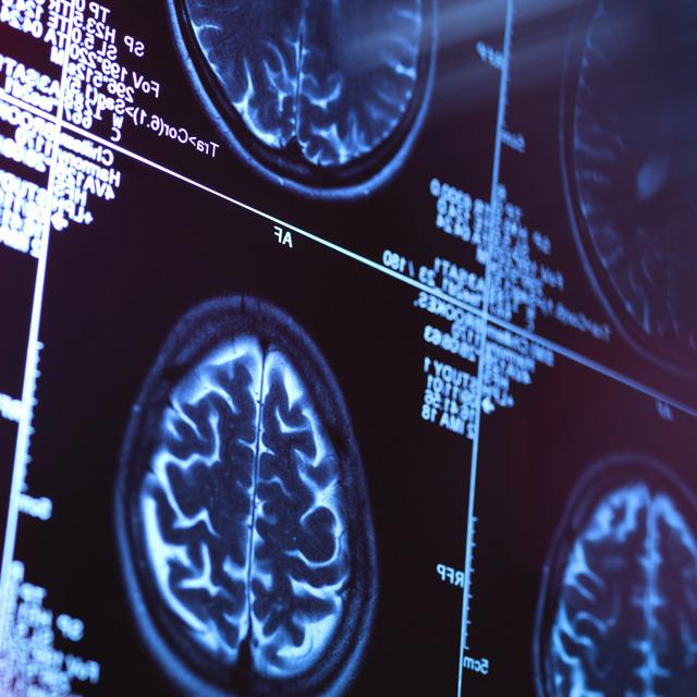 Brain MRI for 神经科学